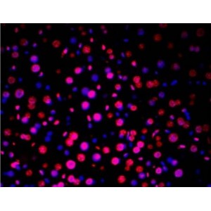 TUNEL LiFluor™ 647 Apoptosis Detection Kit (50 rxns)